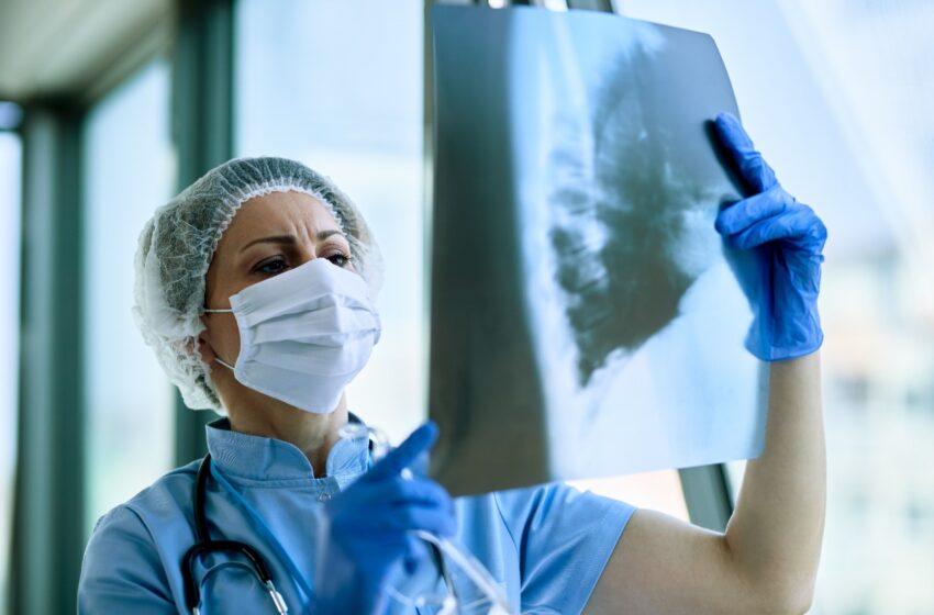  Aumento de tomografias de tórax na pandemia revela diagnósticos de câncer de pulmão